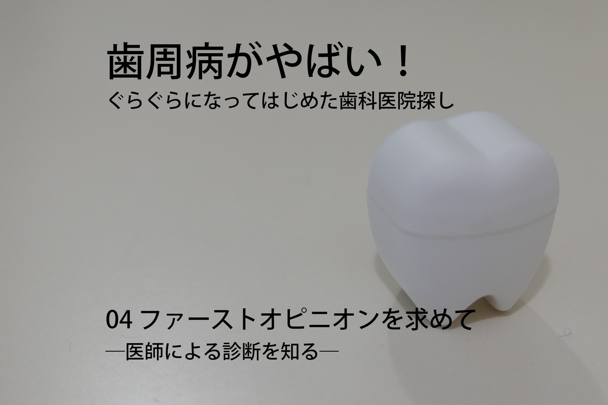 歯周病がやばい!ぐらぐらになってはじめた歯科医院探し04 ファーストオピニオンを求めて―医師による診断を知る―