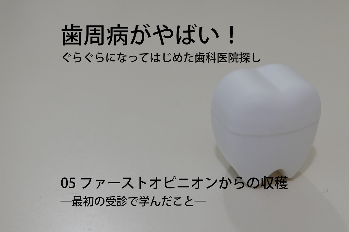 歯周病がやばい!ぐらぐらになってはじめた歯科医院探し05 ファーストオピニオンからの収穫―最初の受診で学んだこと―