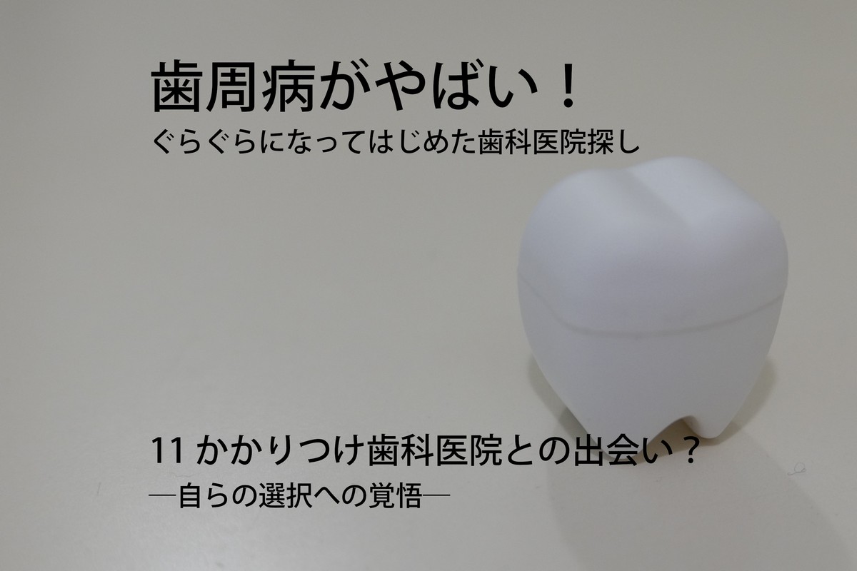 歯周病がやばい!ぐらぐらになってはじめた歯科医院探し11 かかりつけ歯科医院との出会い?―自らの選択への覚悟―